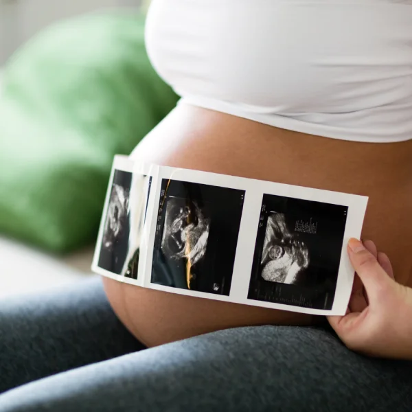 Salud Materno Infantil y Etapas de Vida